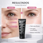 EyeLift - Tratamiento reafirmante para el contorno de ojos