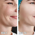 Sistema Rejuvenecedor Neuvire BioLift™
