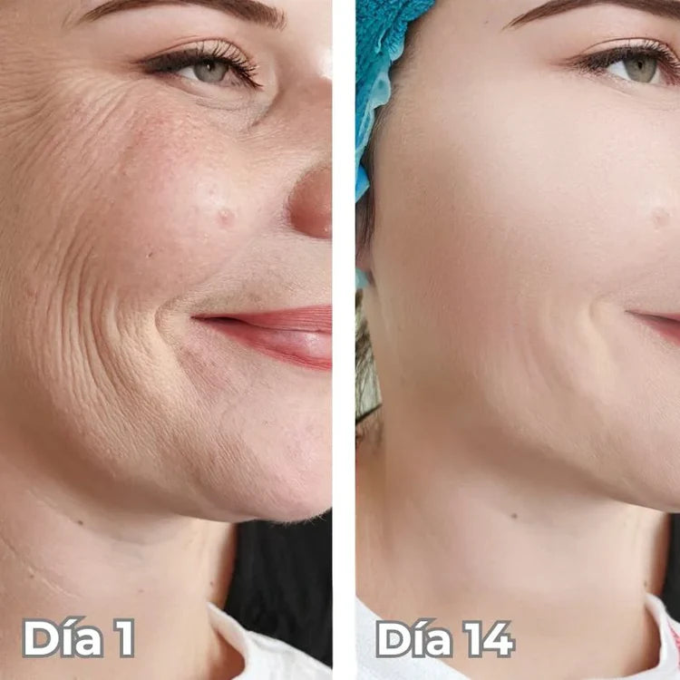 Sistema Rejuvenecedor Neuvire BioLift™