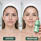 ClearSpot™ Equilibra, Limpia y Refina la Textura de tu Piel.