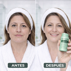 ClearSpot™ Equilibra, Limpia y Refina la Textura de tu Piel.