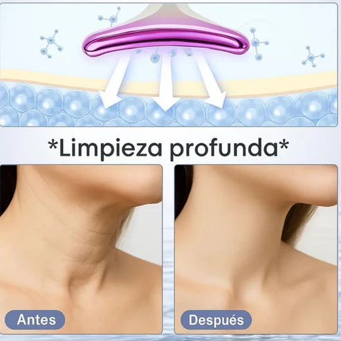 Sistema Rejuvenecedor Neuvire BioLift™