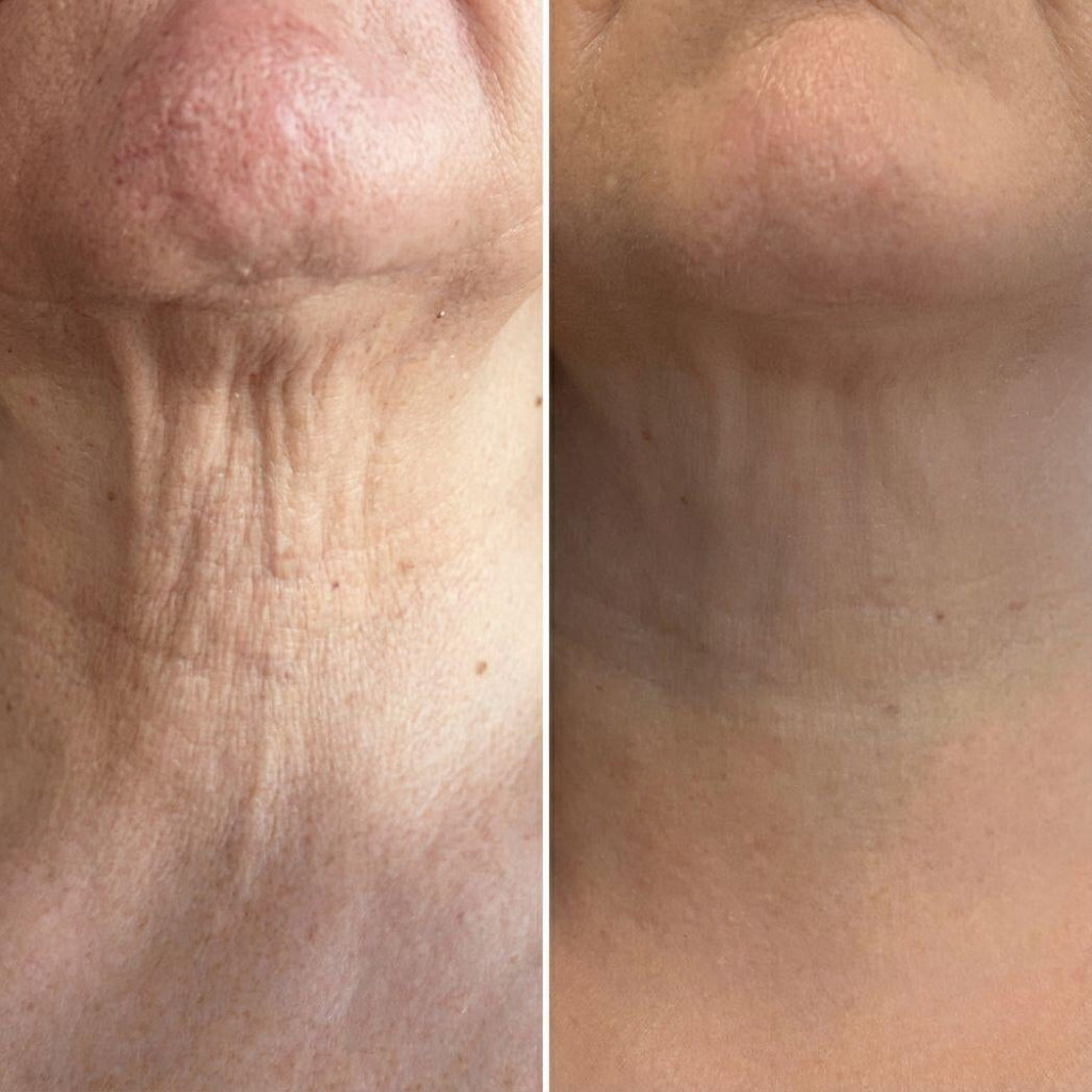 Crema con Masajeador 3D para Cuello